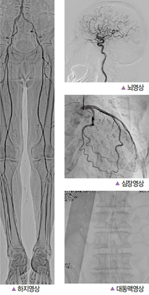 하지영상, 뇌영상, 심장영상, 대동맥영상 사진